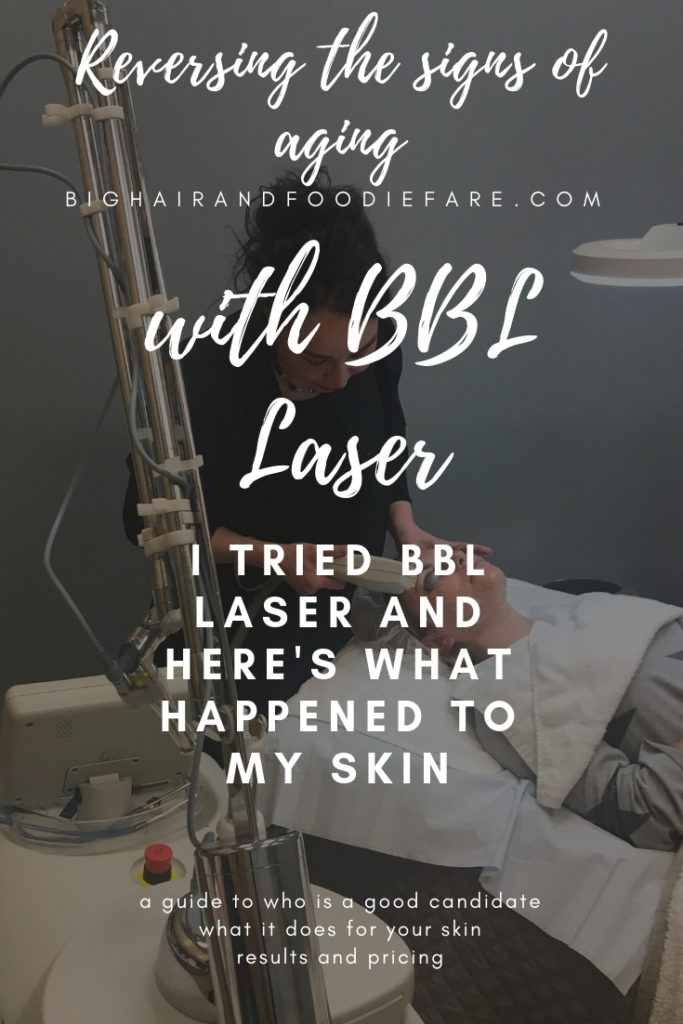 I tried BBL Laser and here is what happened to my skin